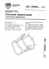 Вкладыш для формирования носового входа (патент 1598981)