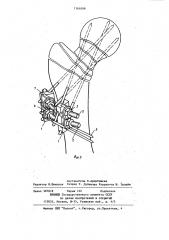 Устройство для остеосинтеза переломов шейки бедренной кости (патент 1161099)