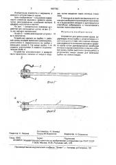 Устройство для уменьшения храпа (патент 1697792)