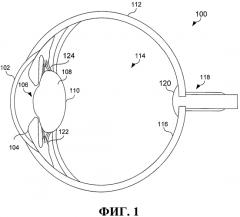 Дифракционная конструкция со смещением фазы области центра-дальней зоны для глазного имплантата (патент 2552699)