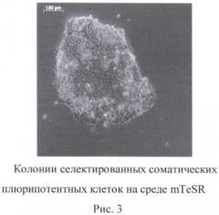 Способ получения плюрипотентных клеток (патент 2399667)