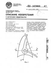 Зубной протез (патент 1475633)