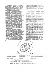 Протез для митрального клапана сердца (патент 1205905)