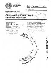 Протез легочной артерии (патент 1362467)