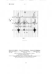 Способ сейсмокардиографии (патент 131018)