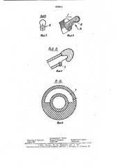 Устройство для удаления хрусталиковых масс (патент 1572614)