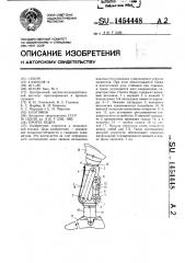 Протез бедра (патент 1454448)