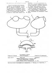 Способ получения искусственных органов из аутоматериалов (патент 1296146)