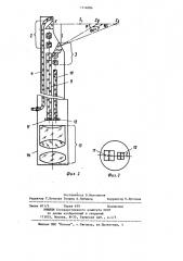 Эндоскоп (патент 1214084)