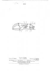 Протез предплечья с биоэлектрическим управлением (патент 396112)