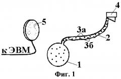 Имплантируемый программируемый электростимулятор карашурова с.е. для стимуляции органов и тканей организма (патент 2243790)