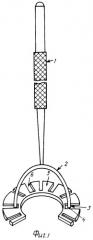 Устройство для фиксации глазного яблока при выполнении антиглаукоматозной лазерциклокоагуляции (патент 2408341)