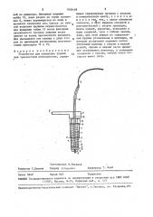Устройство для измерения усилий при чрескостном остеосинтезе (патент 1602498)