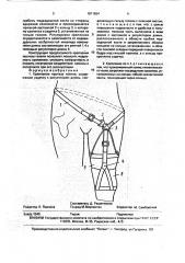 Крепление протеза голени (патент 1811824)