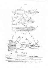 Пинцет (патент 1797870)