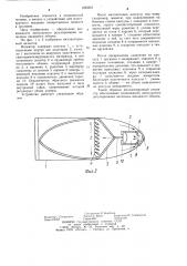 Имплантируемый инъектор (патент 1225581)