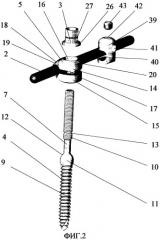 Спинальное устройство, преимущественно для соединительных штанг (патент 2301040)