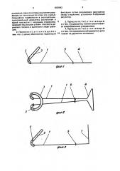 Протез для импотентов (патент 1836942)