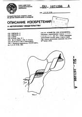 Устройство для остеосинтеза (патент 1071298)