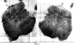Способ формирования представления (шаблона) папиллярных узоров ладони человека (патент 2554520)