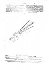 Устройство для остеосинтеза (патент 1764639)