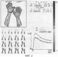 Способ оценки резерва кровообращения конечности (патент 2304926)