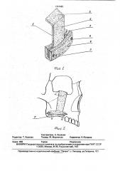Эндопротез верхней челюсти (патент 1797485)