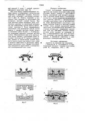Способ изготовления нижнечелюстных протезов при полном отсутствии зубов (патент 725662)