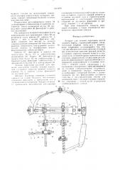 Аппарат для лечения переломов костей лицевого черепа (патент 1491490)