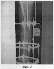 Способ лечения ложных суставов трубчатых костей с рубцово-измененными мягкими тканями (патент 2309690)