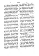 Штамм гибридных культивируемых клеток животных mus musculus l., используемый для получения моноклональных антител к jgg 1, 3, 4 человека (патент 2002803)