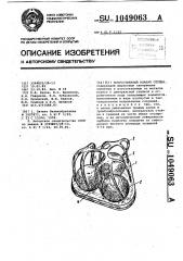 Искусственный клапан сердца (патент 1049063)