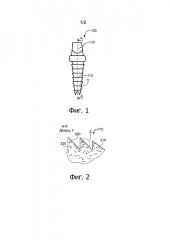 Композитная деталь для внутрикостной имплантации и способ изготовления такой детали (патент 2609870)