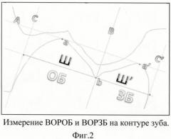 Способ измерения размеров зубов, зубных бугров и их внутренних и наружных скатов (патент 2438617)