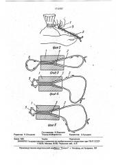 Способ затягивания петли шнура в зажиме в виде обоймы (патент 1712707)