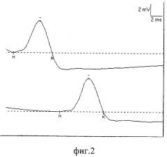 Способ лечения повреждений периферических нервов (патент 2294225)
