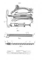 Устройство ю.п.богача для внутриполостного массажа (патент 1510846)