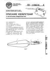 Внутриаортальный баллон-насос для вспомогательного кровообращения (патент 1186216)