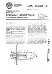 Способ панкреатоеюностомии (патент 1563677)