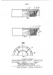 Узел крепления лобовых частей обмотки статора электрической машины (патент 936236)