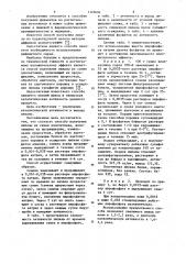 Способ получения липазы (патент 1122694)