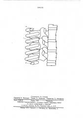 Устройство для фиксации позвоночника (патент 596232)