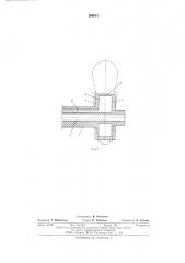 Устройство для герметичной обтурации трубчатого органа (патент 599811)