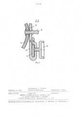 Транспортная шина для нижней конечности (патент 1237206)