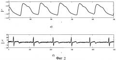 Способ ранней диагностики сердечно-сосудистых заболеваний на основе многоканального спектрального анализа медленных волн кардиосигналов (патент 2537771)