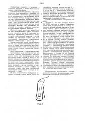 Способ транспозиции мыщелка культи плеча (патент 1158187)