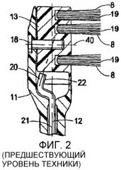 Электрическая зубная щетка (варианты) (патент 2329010)