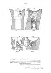 Протез бедра с подтормаживающим устройством (патент 240178)