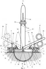 Устройство для сближения краев раны (патент 2371117)
