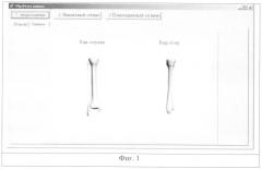 Способ трехмерной визуализации длинных трубчатых костей при диафизарных переломах (патент 2342077)